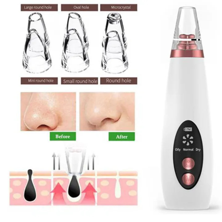 Remove Acne Instrument Blackhead Remover Instrument Black Dot Remover Acne Vacuum Suction Face ...